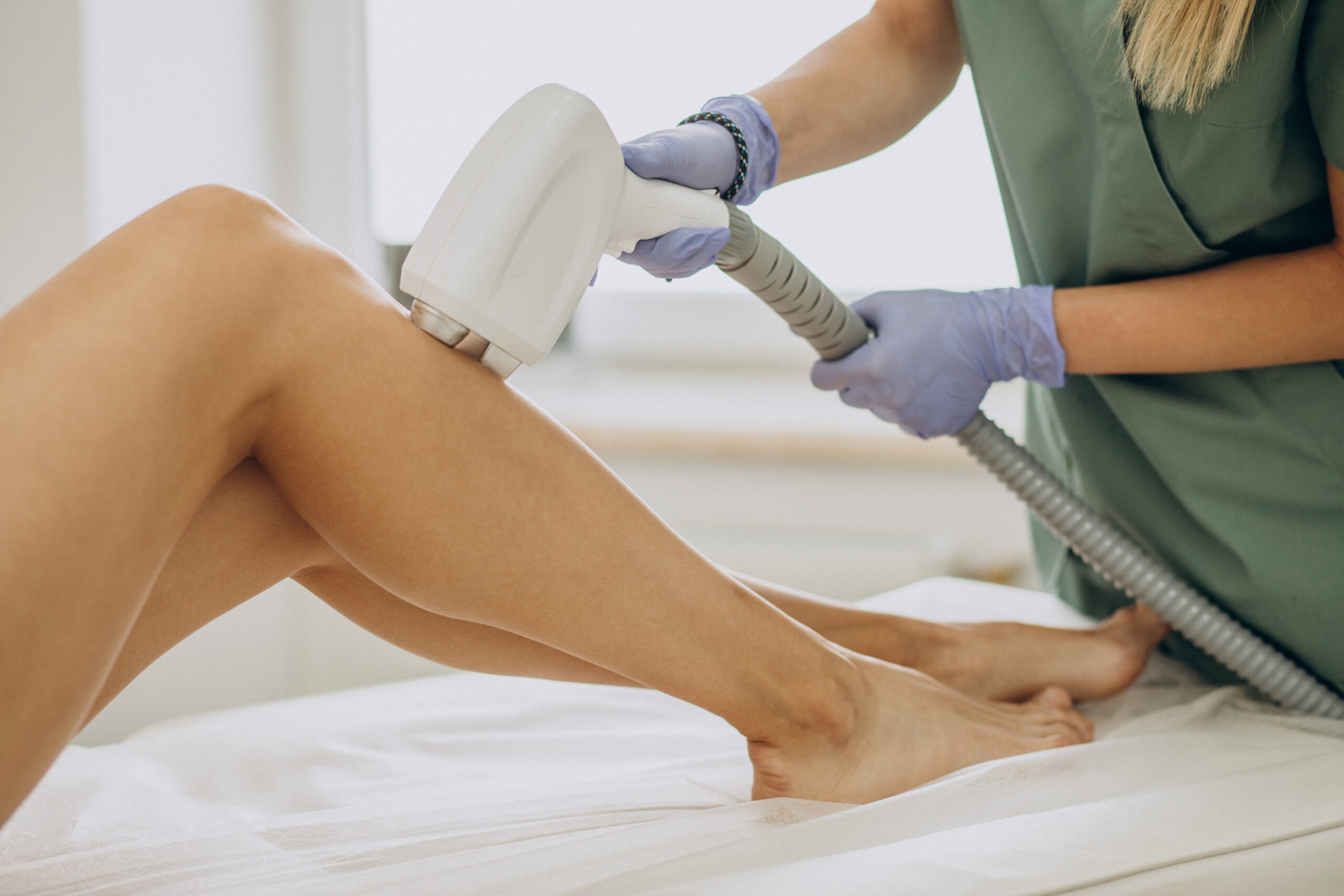 Depilación laser